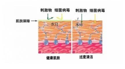 角质层薄可以去角质