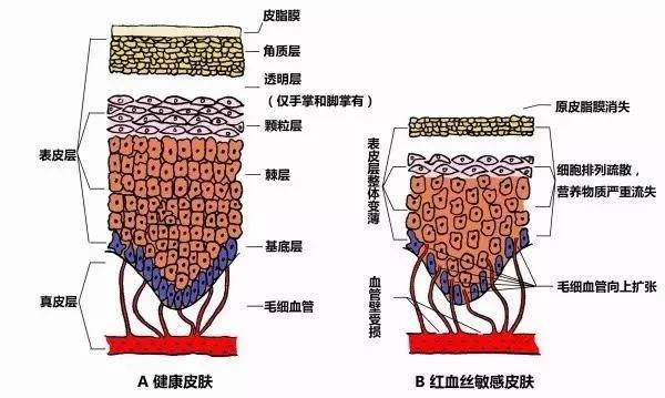 角质层薄适合去角质吗