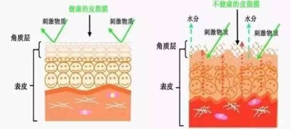 激素脸需要去角质