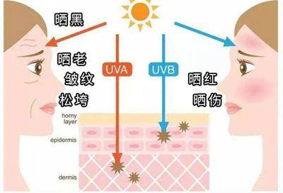 pa是防晒黑还是晒伤